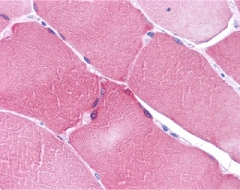 Immunohistochemistry of ARC in human skeletal muscle with ARC antibody at 5 ug/ml.