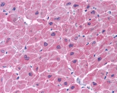 Immunohistochemistry of ARC in human heart tissue with ARC antibody at 5 ug/ml.
