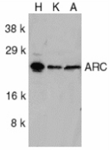 Western blot of ARC in HeLa (H), KB (K), and A549 (A) whole cell lysates with ARC antibody at 1:1000 dilution.
