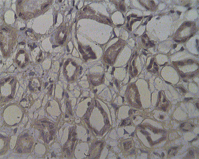 Staining on paraffin embedded normal human kidney sections using NOL4 antibody (LS-C140648) at 10 ug/ml. Antigen retrieval used: 10 mM Na Citrate pH 6.0, 10 minutes pressure cooker method., developed with anti rabbit HRP and DAP substrate. Counterstained with methyl blue.