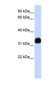MED27 / CRSP8 antibody LS-C109825 Western blot of Fetal Brain lysate.