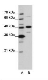 A: Marker, B: HepG2 Cell Lysate