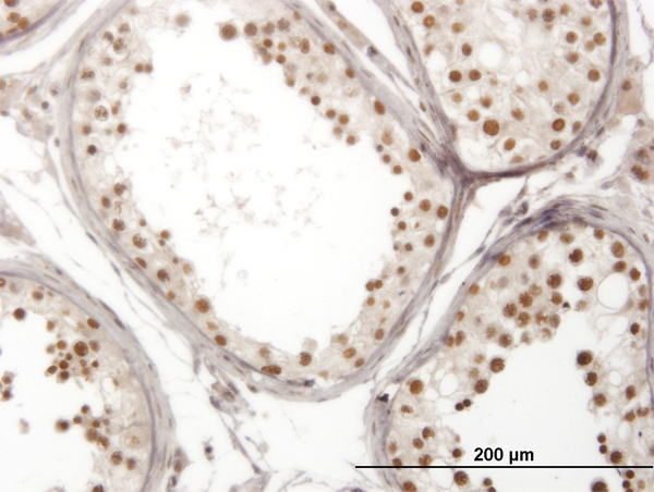 Immunoperoxidase of monoclonal antibody to NOL4 on formalin-fixed paraffin-embedded human testis. [antibody concentration 3 ug/ml]
