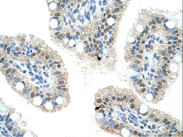 NOL6 antibody LS-C31529 was used in IHC to stain formalin-fixed, paraffin-embedded human intestine.