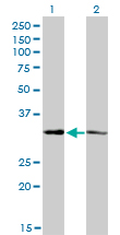 Western blot of CRSP8 expression in transfected 293T cell line by CRSP8 monoclonal antibody (M01), clone 8B8.