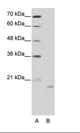 A: Marker, B: HepG2 Cell Lysate