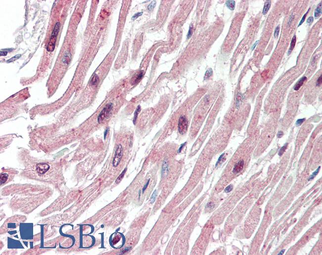 Human Heart: Formalin-Fixed, Paraffin-Embedded (FFPE)