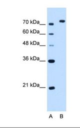 Lane A: Marker. Lane B: HepG2 cell lysate. Antibody concentration: 2.5 ug/ml. Gel concentration: 12%.