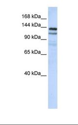 MCF7 cell lysate. Antibody concentration: 1.0 ug/ml. Gel concentration: 6-18%.