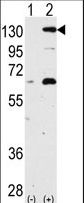 Western blot of NOMO1(arrow) using rabbit polyclonal NOMO1 Antibody (S1205). 293 cell lysates (2 ug/lane) either nontransfected (Lane 1) or transiently transfected with NOMO1 gene (Lane 2) (Origene Technologies).