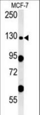 NOMO1-S1205 western blot of MCF-7 cell line lysates (35 ug/lane). The NOMO1 antibody detected the NOMO1 protein (arrow).