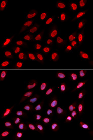 Immunofluorescence analysis of U20S cell using NONO antibody. Blue: DAPI for nuclear staining.