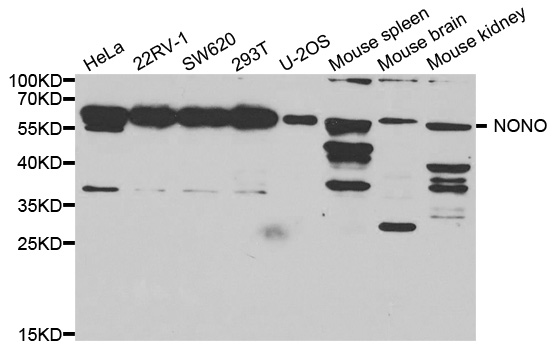 Western blot analysis of extracts of various cell lines,using Nono antibody.
