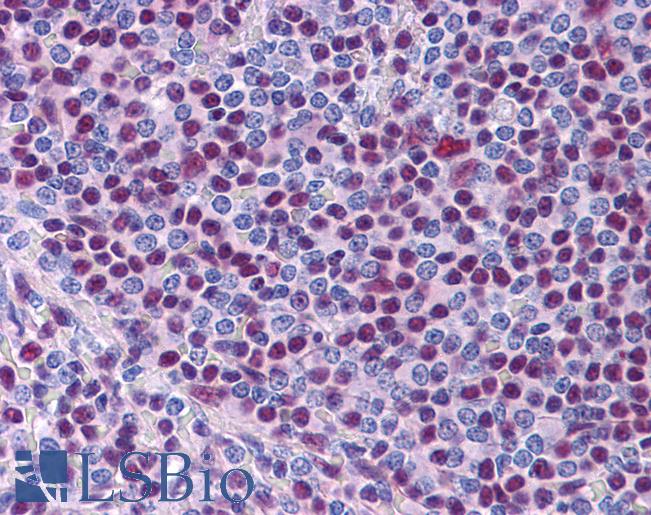 Anti-NONO antibody IHC of human spleen. Immunohistochemistry of formalin-fixed, paraffin-embedded tissue after heat-induced antigen retrieval. Antibody LS-B4329 concentration 3.75 ug/ml.