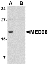 Western blot of MED28 in human brain tissue lysate with MED28 antibody at 1 ug/ml in (A) the absence and (B) the presence of blocking peptide.