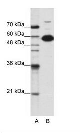 A: Marker, B: HepG2 Cell Lysate