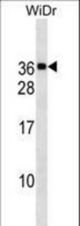 MED30 Antibody western blot of WiDr cell line lysates (35 ug/lane). The MED30 antibody detected the MED30 protein (arrow).