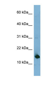 MED31 antibody LS-C107867 Western blot of Fetal Liver lysate.