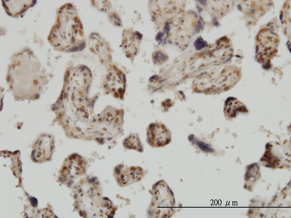 Immunoperoxidase of monoclonal antibody to MED31 on formalin-fixed paraffin-embedded human placenta. [antibody concentration 3 ug/ml]