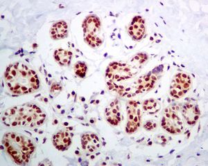 IHC of paraffin-embedded human breast tissue using anti-NOP10 / NOLA3 antibody.