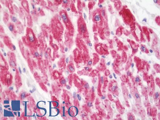 Anti-NOP10 antibody IHC staining of human heart. Immunohistochemistry of formalin-fixed, paraffin-embedded tissue after heat-induced antigen retrieval. Antibody LS-B10969 dilution 1:100.