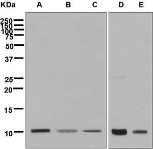 Western blot analysis on (A) 293T, (B) HeLa, (C) Jurkat, (D) HuT-78, and (E) Caco-2 cell lysates using anti-NOP10 / NOLA3 antibody.