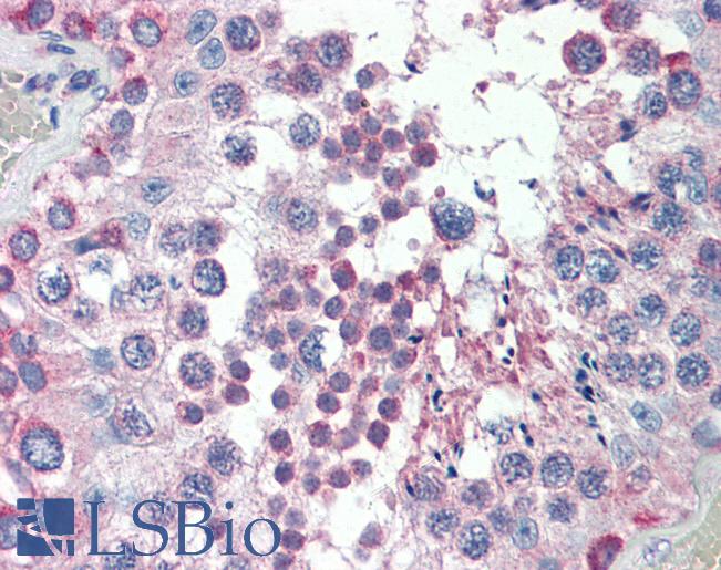 Anti-MED4 antibody IHC of human testis. Immunohistochemistry of formalin-fixed, paraffin-embedded tissue after heat-induced antigen retrieval. Antibody LS-B3562 concentration 5 ug/ml.