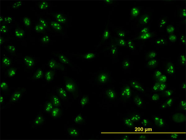 Immunofluorescence of monoclonal antibody to HSPC111 on HeLa cell. [antibody concentration 10 ug/ml]