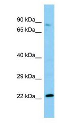 NOP2 antibody Western Blot of Rat Testis.