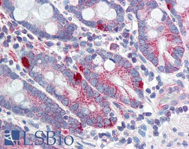 Anti-MED4 antibody IHC of human small intestine. Immunohistochemistry of formalin-fixed, paraffin-embedded tissue after heat-induced antigen retrieval. Antibody LS-B3562 concentration 5 ug/ml.