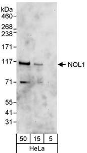 Detection of Human NOL1 by Western Blot. Samples: Whole cell lysate (5, 15 and 50 ug) from HeLa cells. Antibodies: Affinity purified rabbit anti-NOL1 antibody used for WB at 0.1 ug/ml. Detection: Chemiluminescence with an exposure time of 60 seconds.