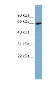 NOP58 antibody LS-C107861 Western blot of MCF7 cell lysate.