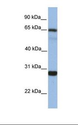 Fetal liver lysate. Antibody concentration: 1.0 ug/ml. Gel concentration: 12%.