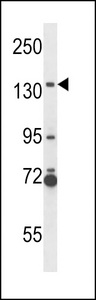 NOS2A Antibody western blot of NCI-H292 cell line lysates (35 ug/lane). The NOS2A antibody detected the NOS2A protein (arrow).