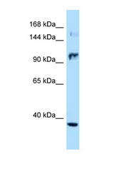 NOS2 antibody LS-C146027 Western blot of Jurkat Cell lysate. Antibody concentration 1 ug/ml.