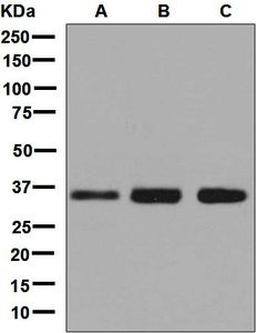 Western blot analysis on (A) HepG2, (B) T47-D, and (C) K562 cell lysates using anti-MED4 antibody.