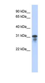 MED6 antibody LS-C109878 Western blot of Transfected 293T cell lysate.