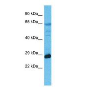 Western blot of Human Esophagus Tumor. MED6 antibody dilution 1.0 ug/ml.