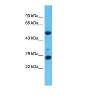 Western blot of Human Lung Tumor. MED6 antibody dilution 1.0 ug/ml.