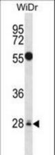 MED6 Antibody western blot of WiDr cell line lysates (35 ug/lane). The MED6 antibody detected the MED6 protein (arrow).