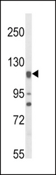 Western blot of NOS3 Antibody in HL-60 cell line lysates (35 ug/lane). NOS3 (arrow) was detected using the purified antibody.