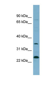 NOSIP antibody LS-C108078 Western blot of OVCAR-3 cell lysate.