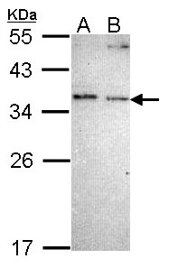 Sample (30 ug of whole cell lysate). A: A431 , B: H1299. 12% SDS PAGE. NOSIP antibody diluted at 1:1000.