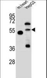 NOSTRIN Antibody western blot of mouse heart tissue and HepG2 cell line lysates (35 ug/lane). The NOSTRIN antibody detected the NOSTRIN protein (arrow).