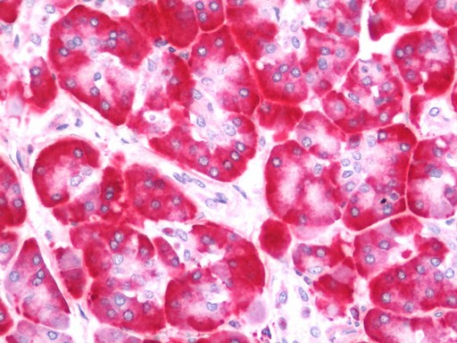 Human Pancreas: Formalin-Fixed, Paraffin-Embedded (FFPE)