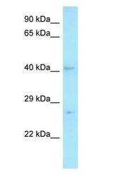 MED7 / CRSP9 antibody Western Blot of Fetal Thymus.