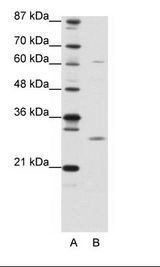 A: Marker, B: 293T Cell Lysate
