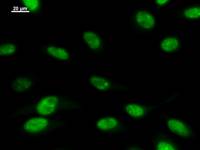 Immunostaining analysis in HeLa cells. HeLa cells were fixed with 4% paraformaldehyde and permeabilized with 0.1% Triton X-100 in PBS. The cells were immunostained with anti-CRSP9 mAb.