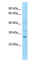 NOTCH2NL antibody Western Blot of Jurkat.