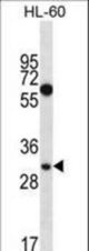 MED8 Antibody western blot of HL-60 cell line lysates (35 ug/lane). The MED8 antibody detected the MED8 protein (arrow).